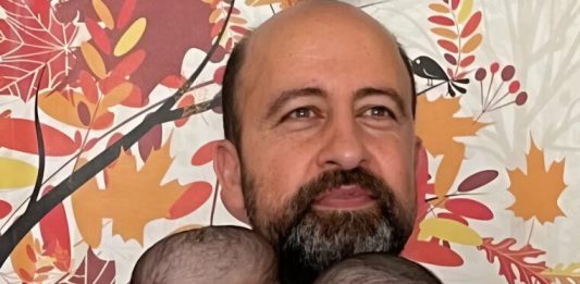 Od jedne glave do dva odvojena života: kako su Manal i Mirha dobile novu šansu poslije zahtjevne operacije Od jedne glave do dva odvojena života: kako su Manal i Mirha dobile novu šansu poslije zahtjevne operacije - featured image