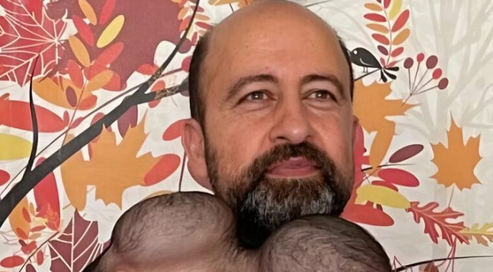 Od jedne glave do dva odvojena života: kako su Manal i Mirha dobile novu šansu poslije zahtjevne operacije Od jedne glave do dva odvojena života: kako su Manal i Mirha dobile novu šansu poslije zahtjevne operacije - featured image