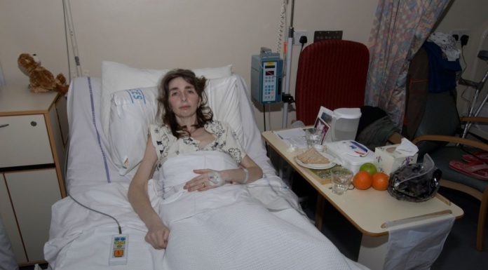 Okrenula sam se da dam ćerki hranu kad mi je nešto “KVRCNULO” U RAMENU, mislila sam da sam istegla mišić, a dobila sam dijagnozu OD KOJE MI SE DIGLA KOSA NA GLAVI