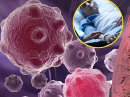 8 namirnica koje smanjuju upale i jačaju imunitet — savršen početak dana