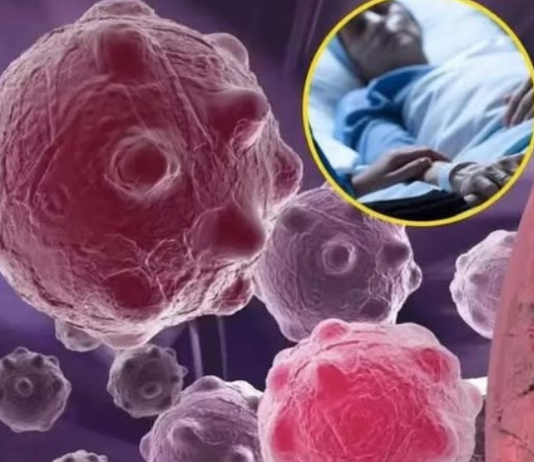 8 namirnica koje smanjuju upale i jačaju imunitet — savršen početak dana