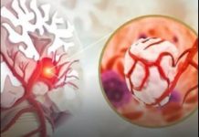 3 simptoma raka koji se javljaju ujutru: Upozoravaju na metastaze, a evo šta odmah treba uraditi