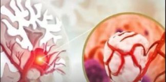 3 simptoma raka koji se javljaju ujutru: Upozoravaju na metastaze, a evo šta odmah treba uraditi