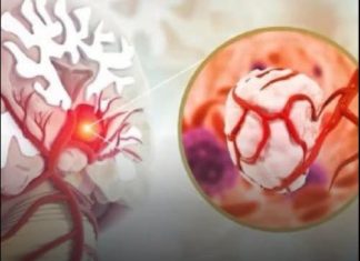 3 simptoma raka koji se javljaju ujutru: Upozoravaju na metastaze, a evo šta odmah treba uraditi