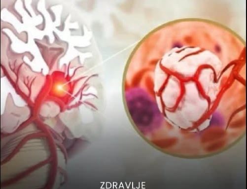 3 simptoma raka koji se javljaju ujutru: Upozoravaju na metastaze, a evo šta odmah treba uraditi