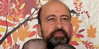 Od jedne glave do dva odvojena života: kako su Manal i Mirha dobile novu šansu poslije zahtjevne operacije