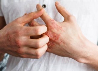 Umor, svrab, VISOK KRVNI PRITISAK, BOL U LEĐIMA – Ova bolest je ”TIHI UBICA”, obratite pažnju ako imate neke od ovih simptoma