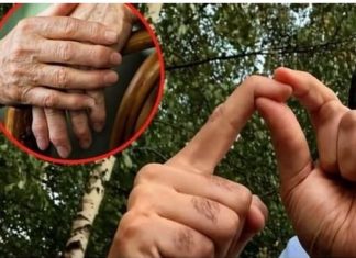OBLOG KOJI IZVLAČI SAV BOL IZ TIJELA: Prirodno riješenje za reumu, išijas, giht i artritis…