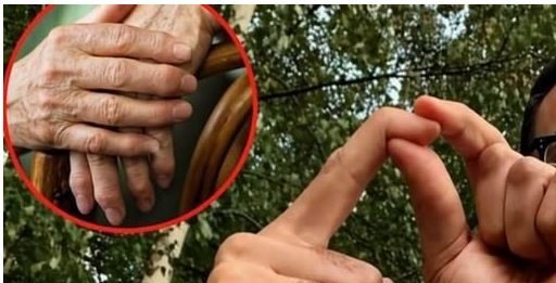OBLOG KOJI IZVLAČI SAV BOL IZ TIJELA: Prirodno riješenje za reumu, išijas, giht i artritis…
