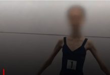 Devojčicu doveli u bolnicu, imala je samo 28 KG I RUČICE TANKE KAO GRISINE: Kad su lekari shvatili koliko ima godina, samo su se UHVATILI ZA GLAVU