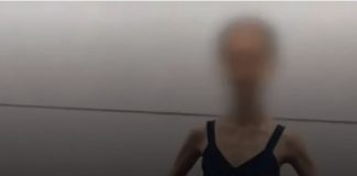 Devojčicu doveli u bolnicu, imala je samo 28 KG I RUČICE TANKE KAO GRISINE: Kad su lekari shvatili koliko ima godina, samo su se UHVATILI ZA GLAVU