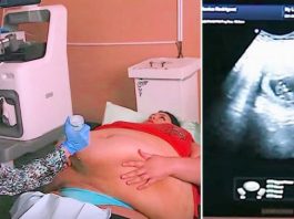 Trudna žena ima 226 kilograma i došla je na ultrazvuk, a onda je medicinska sestra podigla njen stomak i pogledala bolje… (VIDEO)