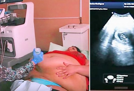 Trudna žena ima 226 kilograma i došla je na ultrazvuk, a onda je medicinska sestra podigla njen stomak i pogledala bolje… (VIDEO)