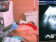 Trudna žena ima 226 kilograma i došla je na ultrazvuk, a onda je medicinska sestra podigla njen stomak i pogledala bolje… (VIDEO)