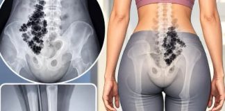 Leđa bole, noge trnu, a vi mislite da će proći? Evo šta može stajati iza toga
