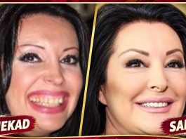 KAD SU SKUPILI PARE, URADILI SU ZUBE: POGLEDAJTE kako su izgledale domaće ličnosti PRIJE UMJETNIH ZUBA – CECA JE HIT (FOTO)