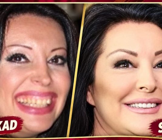 KAD SU SKUPILI PARE, URADILI SU ZUBE: POGLEDAJTE kako su izgledale domaće ličnosti PRIJE UMJETNIH ZUBA – CECA JE HIT (FOTO)