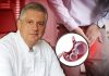 Šta da jedete ako vas muče gasovi? Prof. dr Vešović otkriva koje namirnice i tehnike olakšavaju nadutost